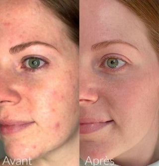 Serum Vinopure Salicílico  Caudalie Producto Francés